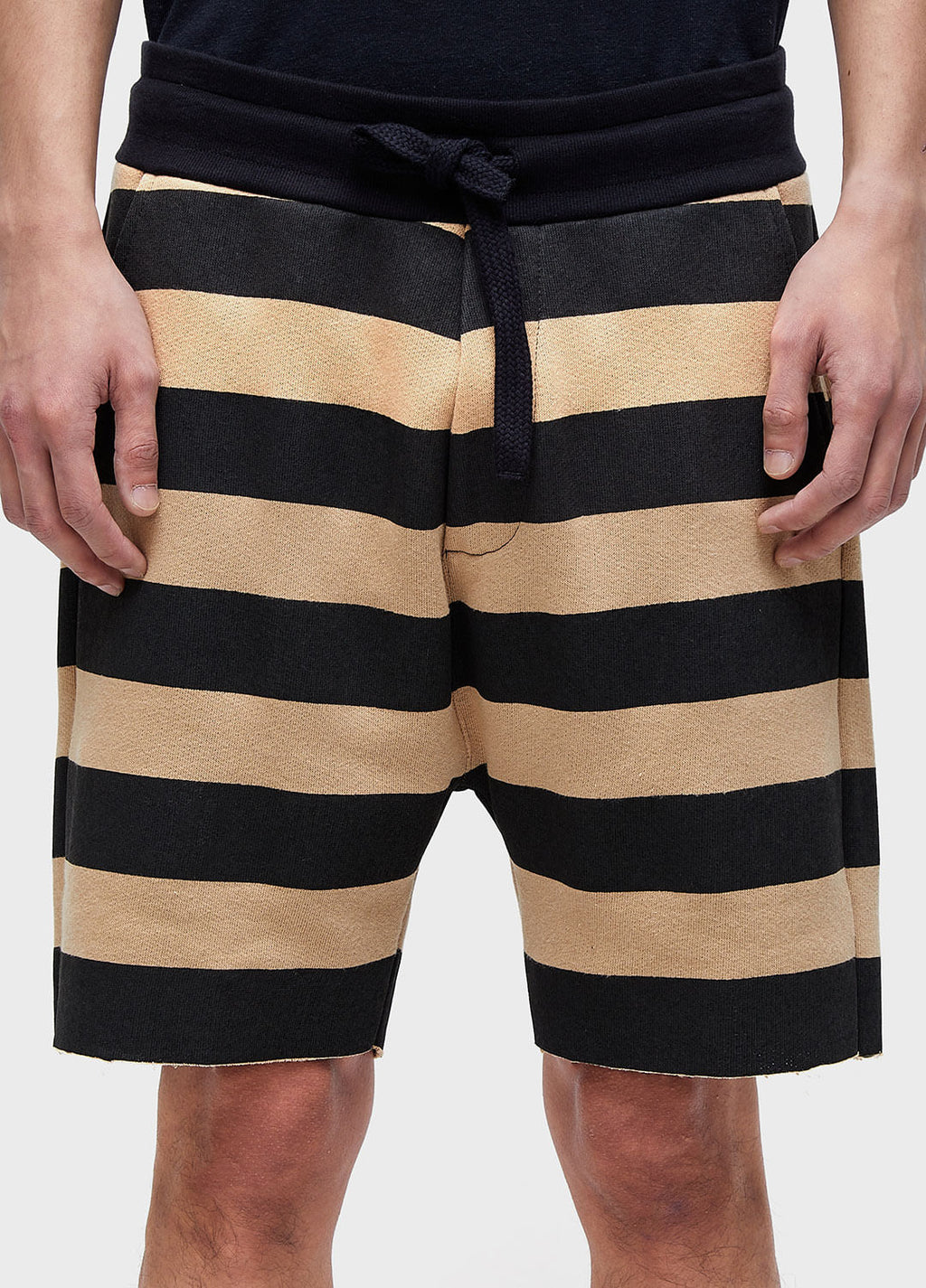 OVERSIZED STRIPED CASUAL BERMUDA SHORTS