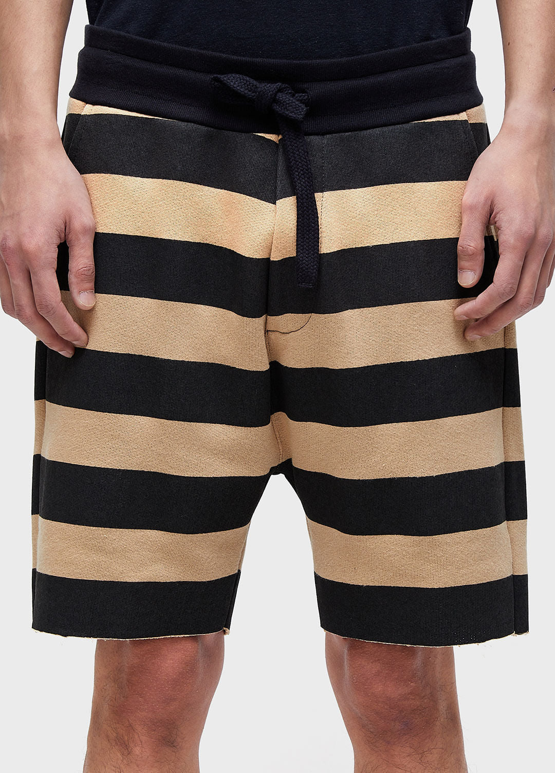 OVERSIZED STRIPED CASUAL BERMUDA SHORTS
